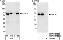 LAP1B Antibody, Novus Biologicals 0.1mL; Unlabeled:Antibodies, Polyclonal