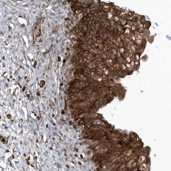 LAPTM4A Antibody, Novus Biologicals 0.1mL; Unlabeled:Antibodies, Polyclonal