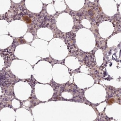 LAPTM5 Antibody, Novus Biologicals 25 μL, Unlabeled:Antibodies, Polyclonal