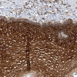 LARP5 Antibody, Novus Biologicals 25 &mu;L; Unlabeled:Antibodies, Polyclonal