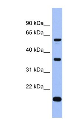 LARP6 Antibody, Novus Biologicals 100&mu;L; Unlabeled:Antibodies, Polyclonal