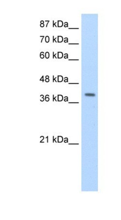 LARP7 Antibody, Novus Biologicals 100&mu;L; Unlabeled:Antibodies, Polyclonal