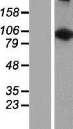 Novus Biologicals&trade;&nbsp;LARS2 Overexpression Lysate