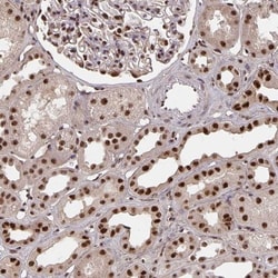 LAS1L Antibody, Novus Biologicals 25 &mu;L, Unlabeled:Antibodies, Polyclonal