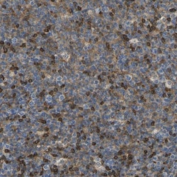 LASP1 Antibody, Novus Biologicals 0.1mL; Unlabeled:Antibodies, Polyclonal