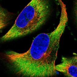 LASS1 Antibody, Novus Biologicals 25 &mu;L | Buy Online | Novus Biologicals | Fisher Scientific