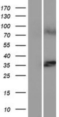 Novus Biologicals&trade;&nbsp;LASS1 Overexpression Lysate