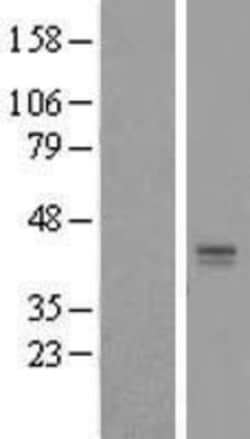 Novus Biologicals&trade;&nbsp;LASS2 Overexpression Lysate