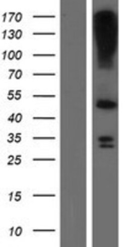 Novus Biologicals&trade;&nbsp;LASS3 Overexpression Lysate