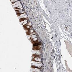 LASS3 Antibody, Novus Biologicals 0.1mL; Unlabeled:Antibodies, Polyclonal
