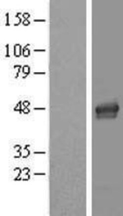 Novus Biologicals™ LASS4 Overexpression Lysate