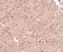 Lass5 Antibody - BSA Free, Novus Biologicals 0.1mg; Unlabeled:Antibodies,