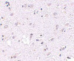 Lass5 Antibody - BSA Free, Novus Biologicals 0.1mg; Unlabeled:Antibodies,