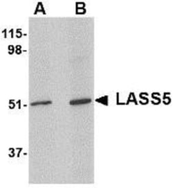 Lass5 Antibody - BSA Free, Novus Biologicals 0.1mg; Unlabeled:Antibodies,