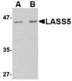 Lass5 Antibody - BSA Free, Novus Biologicals 0.1mg; Unlabeled:Antibodies,