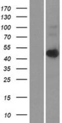 Novus Biologicals&trade;&nbsp;LASS6 Overexpression Lysate