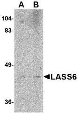 LASS6 Antibody - BSA Free, Novus Biologicals 0.025 mg, Unconjugated:Antibodies,