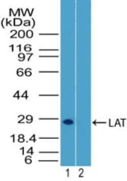 LAT Antibody, Novus Biologicals:Antibodies:Primary Antibodies