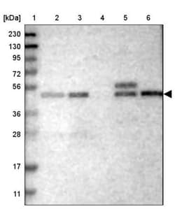 LAT3 Antibody, Novus Biologicals:Antibodies:Primary Antibodies