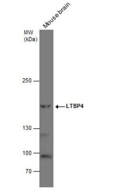 Latent TGF-beta bp4 Antibody, Novus Biologicals 0.1mL:Antibodies, Polyclonal