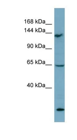 LATS1 Antibody, Novus Biologicals 0.05mg; Unlabeled:Antibodies, Polyclonal