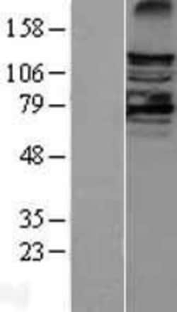 Novus Biologicals&trade;&nbsp;LATS2 Overexpression Lysate