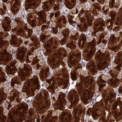 Layilin Antibody, Novus Biologicals 0.1mL; Unlabeled:Antibodies, Polyclonal