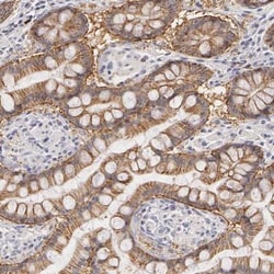 LBP Antibody, Novus Biologicals:Antibodies:Primary Antibodies