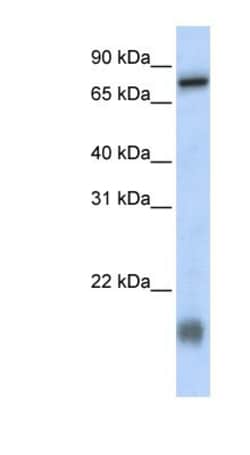 LCA5L Antibody, Novus Biologicals 100&mu;L; Unlabeled:Antibodies, Polyclonal