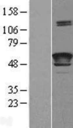 Novus Biologicals&trade;&nbsp;LCAT Overexpression Lysate