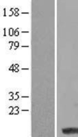 Novus Biologicals&trade;&nbsp;LCE3D Overexpression Lysate