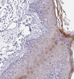 LCE6A Antibody, Novus Biologicals:Antibodies:Primary Antibodies