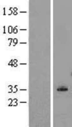 Novus Biologicals&trade;&nbsp;LCLAT1 Overexpression Lysate
