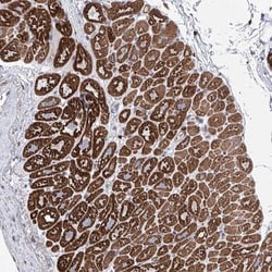 LCLAT1 Antibody, Novus Biologicals:Antibodies:Primary Antibodies
