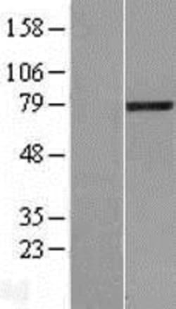 Novus Biologicals™ LCMT2 Overexpression Lysate