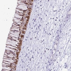 LCN15 Antibody, Novus Biologicals:Antibodies:Primary Antibodies