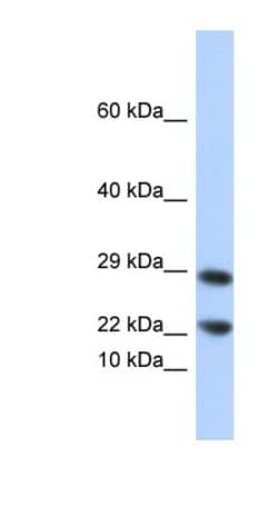 LCN8 Antibody, Novus Biologicals 100&mu;L; Unlabeled:Antibodies, Polyclonal