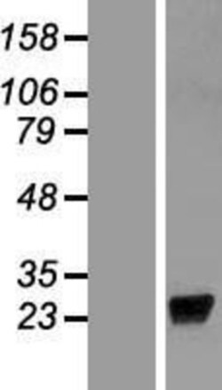 Novus Biologicals&trade;&nbsp;LCN9 Overexpression Lysate
