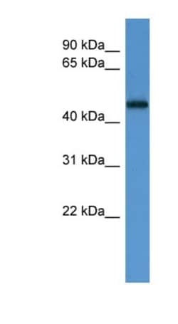 LCoR Antibody, Novus Biologicals 100&mu;L; Unlabeled:Antibodies, Polyclonal