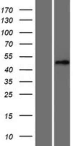 Novus Biologicals&trade;&nbsp;LCoR Overexpression Lysate