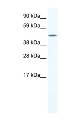 LCORL Antibody, Novus Biologicals 100&mu;L; Unlabeled:Antibodies, Polyclonal