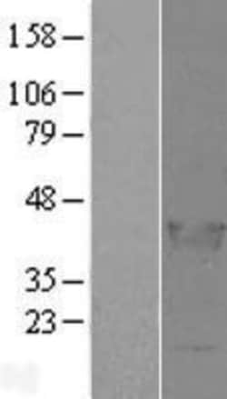 Novus Biologicals™ LCORL Overexpression Lysate