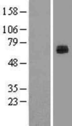 Novus Biologicals&trade;&nbsp;Lactase-like Protein/LCTL Overexpression Lysate