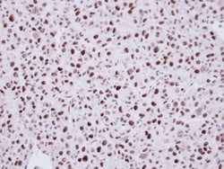 LDB1 Antibody, Novus Biologicals 0.1mL; Unlabeled:Antibodies, Polyclonal