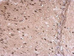 LDB1 Antibody, Novus Biologicals 0.1mL; Unlabeled:Antibodies, Polyclonal