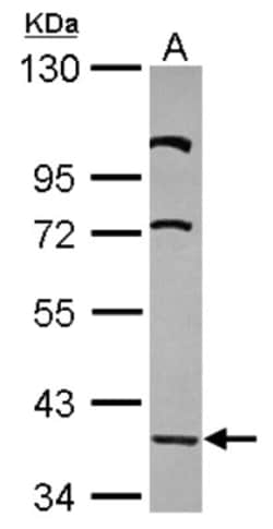 LDB2 Antibody, Novus Biologicals 0.1mL; Unlabeled:Antibodies, Polyclonal