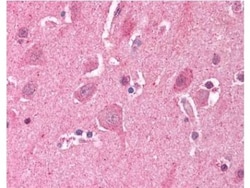 LDB2 Antibody, Novus Biologicals 0.1mg; Unlabeled:Antibodies, Polyclonal