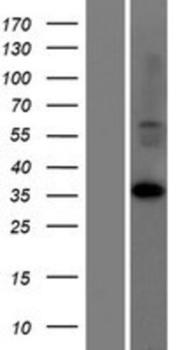 Novus Biologicals&trade;&nbsp;LDHAL6A Overexpression Lysate