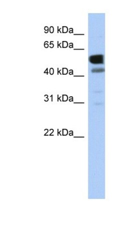 LDHD Antibody, Novus Biologicals 100&mu;L; Unlabeled:Antibodies, Polyclonal