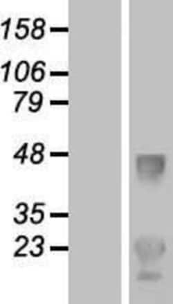 Novus Biologicals&trade;&nbsp;LDLRAD1 Overexpression Lysate